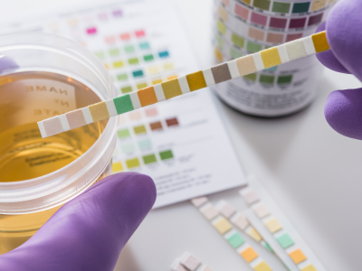 Ergebnis Jodsättigungstest