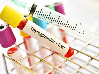 Blutwerte Schilddrüse